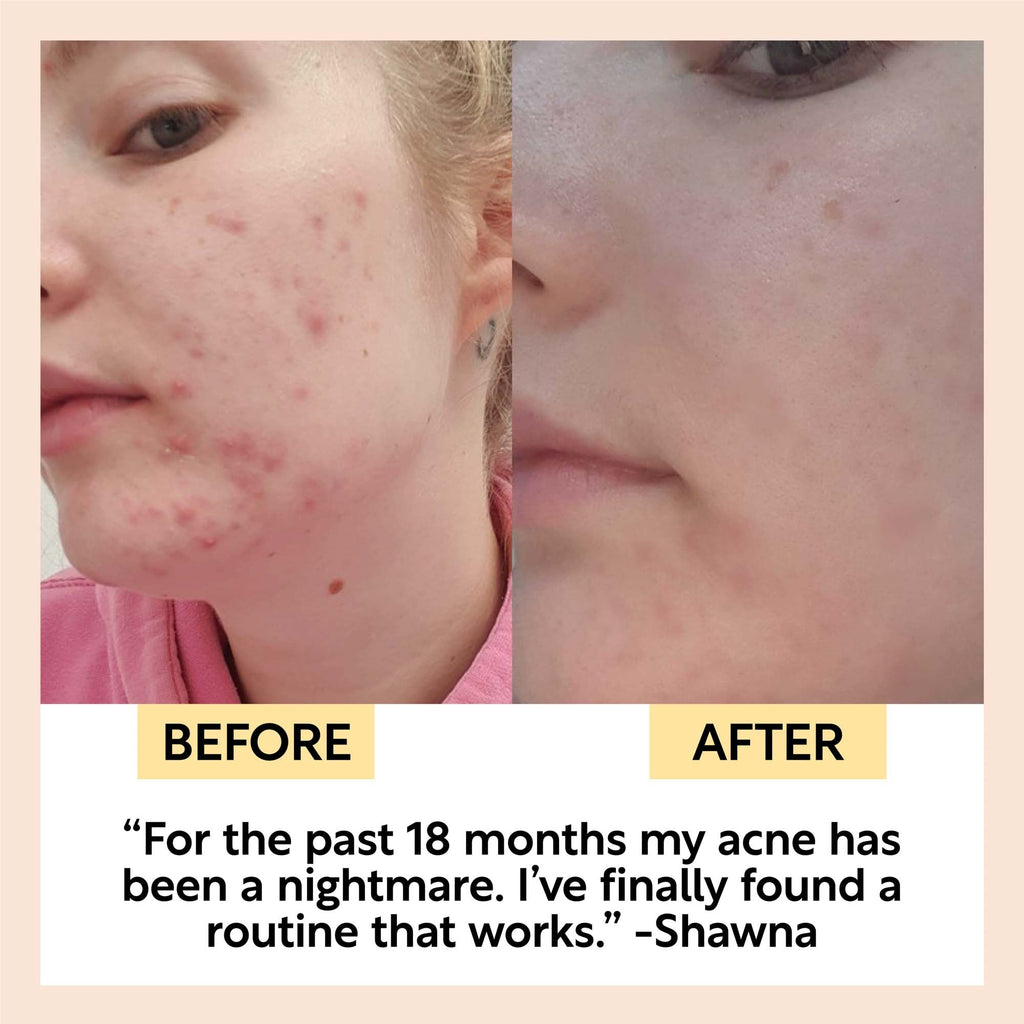 Double Cleansing Duo