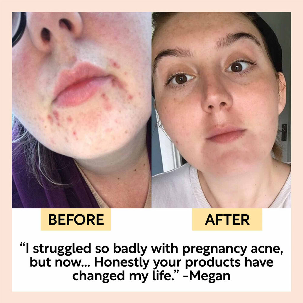 Face Moisturizer with Vitamin E — 3x Award Winner | Travel Size